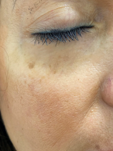 After image for Κατερίνα Γ.