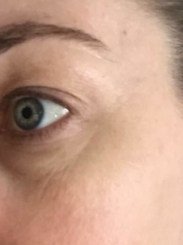 Before image for Αριάδνη Ε.