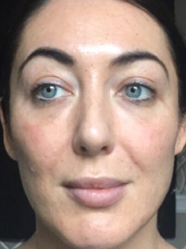 After image for Μαρίνα Π.