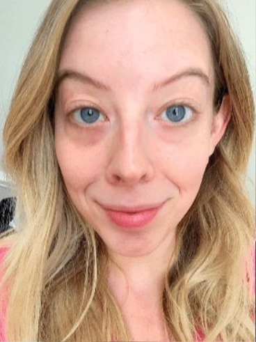 Before image for Νάνσυ Π.