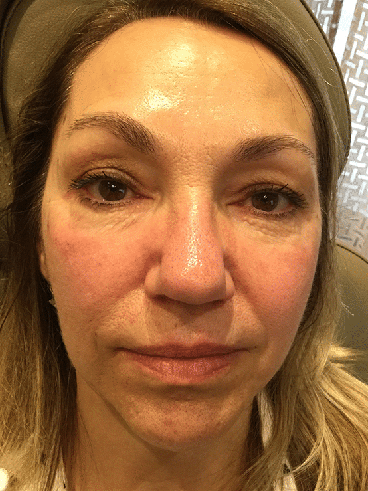 After image for Ελένη Α.