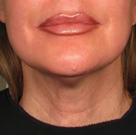 After image for Αγγελική Κ.