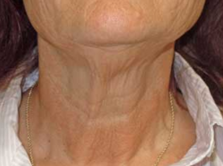 Before image for Αργυρώ Μ.