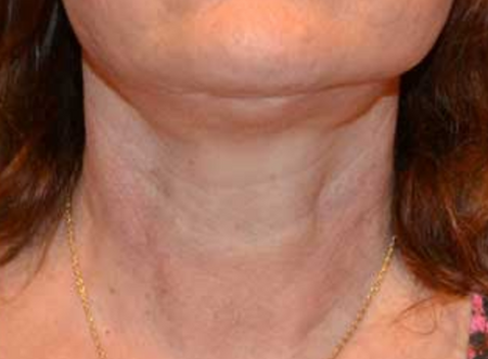 After image for Αργυρώ Μ.