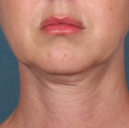 Before image for Γεωργία Π.