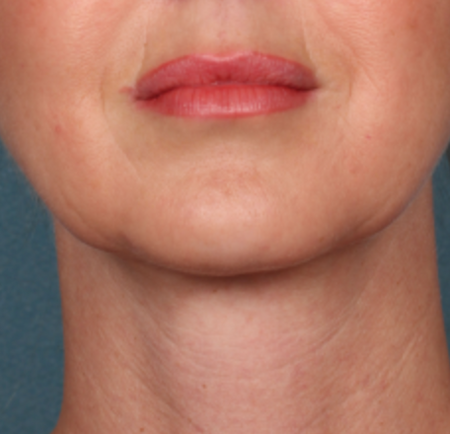 After image for Γεωργία Π.