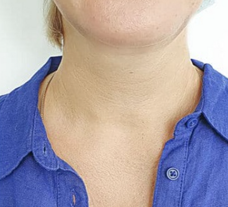 After image for Ναυσικά Α.