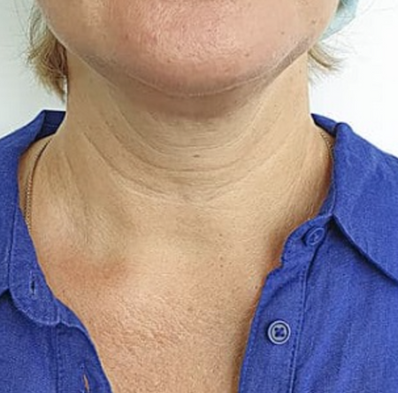 Before image for Ναυσικά Α.