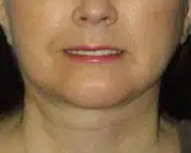 After image for Όλγα Κ.