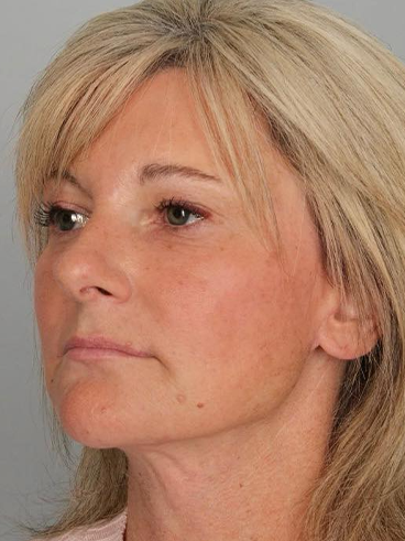 After image for Αναστασία Κ.