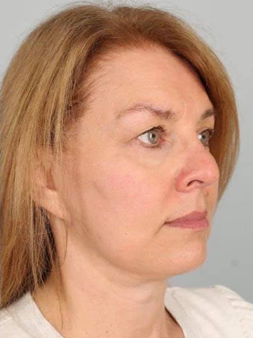 After image for Παρασκευή Κ.