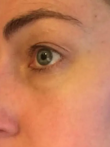 After image for Βιργινία Α.