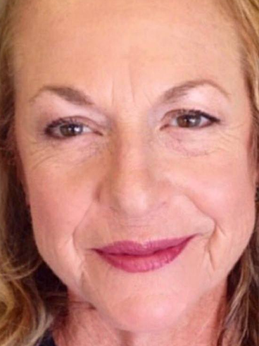 After image for ΣΤΕΛΛΑ Π.