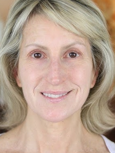 Before image for Μαρία Κ.