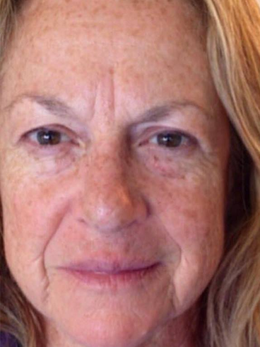 Before image for ΣΤΕΛΛΑ Π.