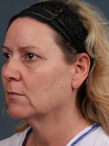 Before image for Δήμητρα Κ.