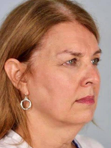 Before image for Παρασκευή Κ.