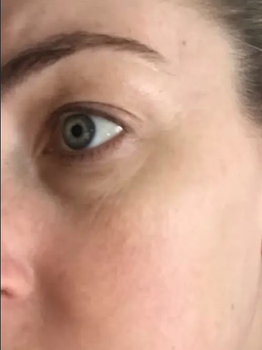 Before image for Βιργινία Α.