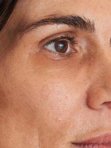 Before image for Μαρία Π.