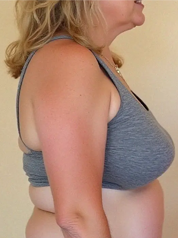 After image for Χριστίνα Β.