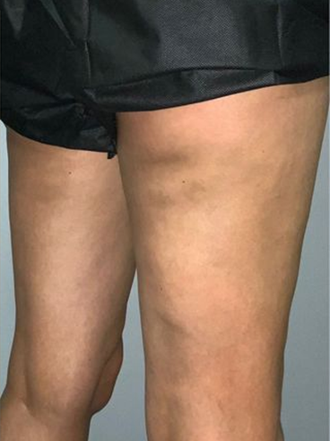 After image for Ιωάννα Α.