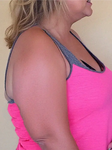 Before image for Χριστίνα Β.