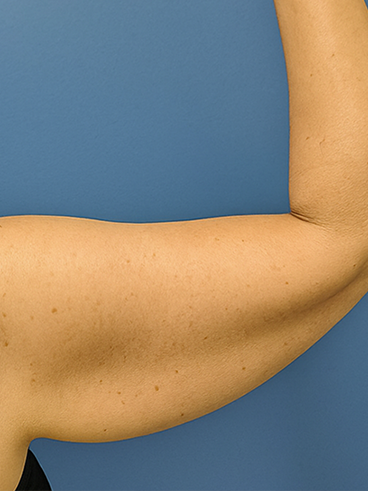 Before image for Άννα Μ.