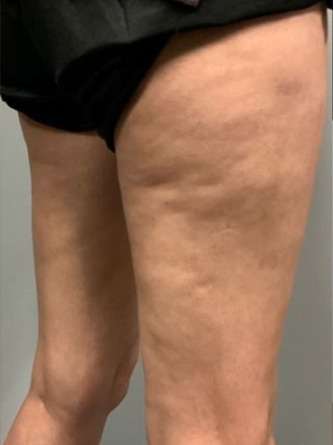 Before image for Ιωάννα Α.