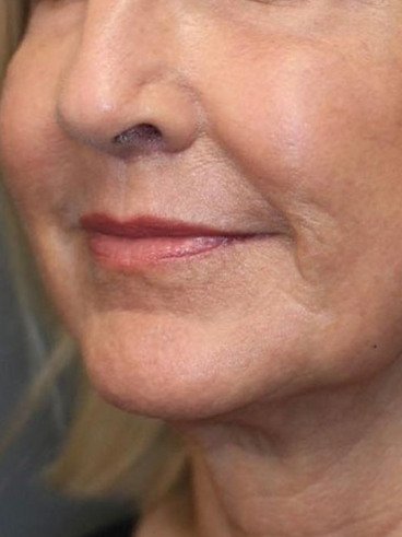 After image for Αλεξάνδρα Μ.