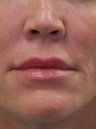 After image for Ειρήνη Κ.