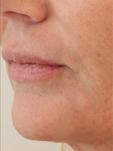 After image for Γεωργία Α.