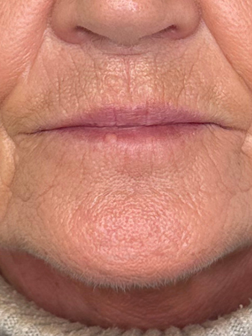 After image for Τζένη Β.