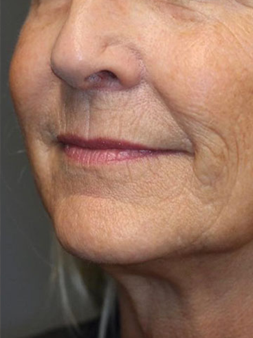 Before image for Αλεξάνδρα Μ.