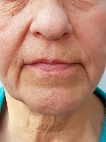 Before image for Δήμητρα Κ.