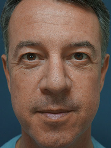 After image for Αποστόλης Κ.