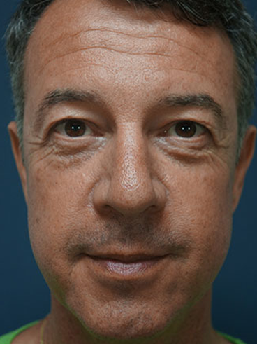 Before image for Αποστόλης Κ.