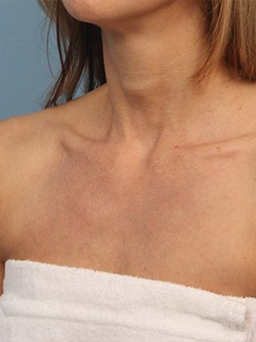 After image for Δανάη Π.