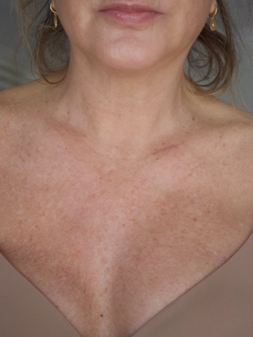 After image for Ζωή Δ.