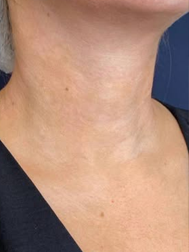 After image for Δήμητρα Κ.