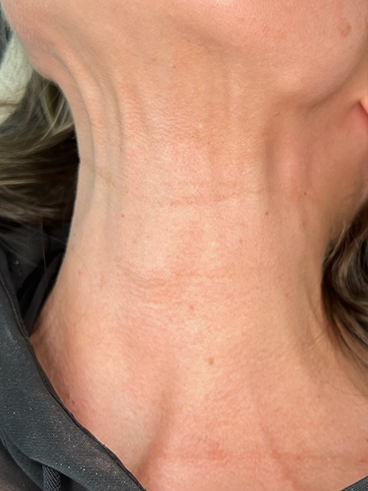 After image for Τζένη Β.