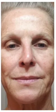 After image for Τόνια Β.