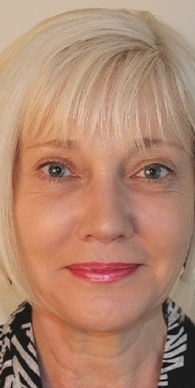 After image for Κατερίνα Μ.