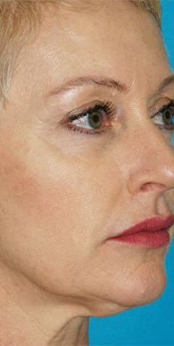 After image for Ελένη Κ.