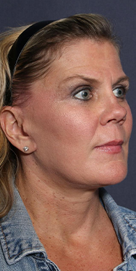 After image for Αναστασία Κ.