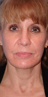 After image for Γιάννα Α.