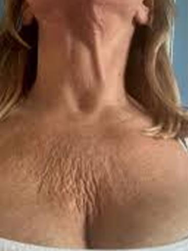 Before image for Ασημίνα Κ.