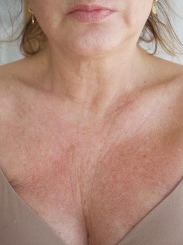 Before image for Ζωή Δ.