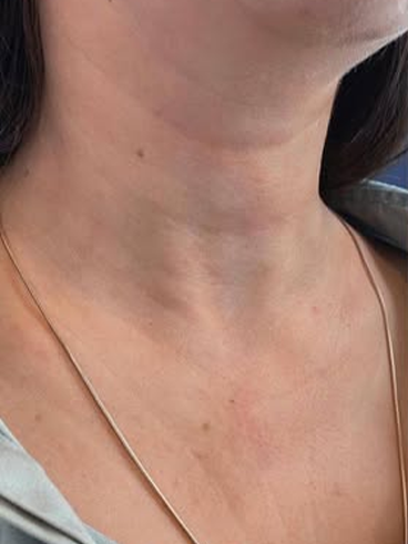 Before image for Δήμητρα Κ.