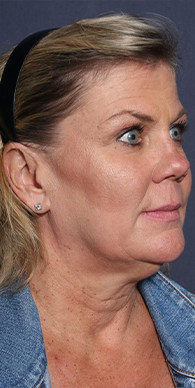 Before image for Αναστασία Κ.