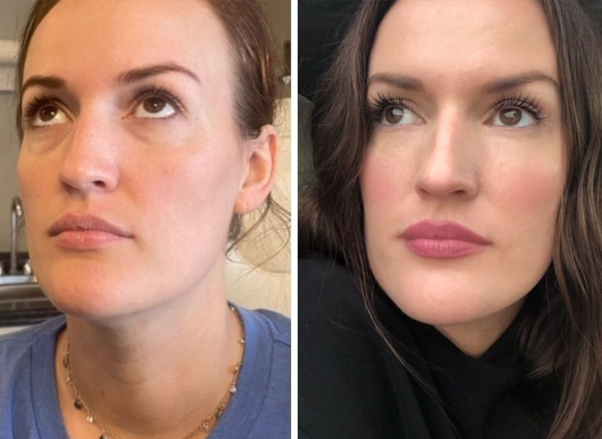 Αποτελέσματα που Σοκάρουν – Δείτε & Νιώστε τη Διαφορά στο Βλέμμα